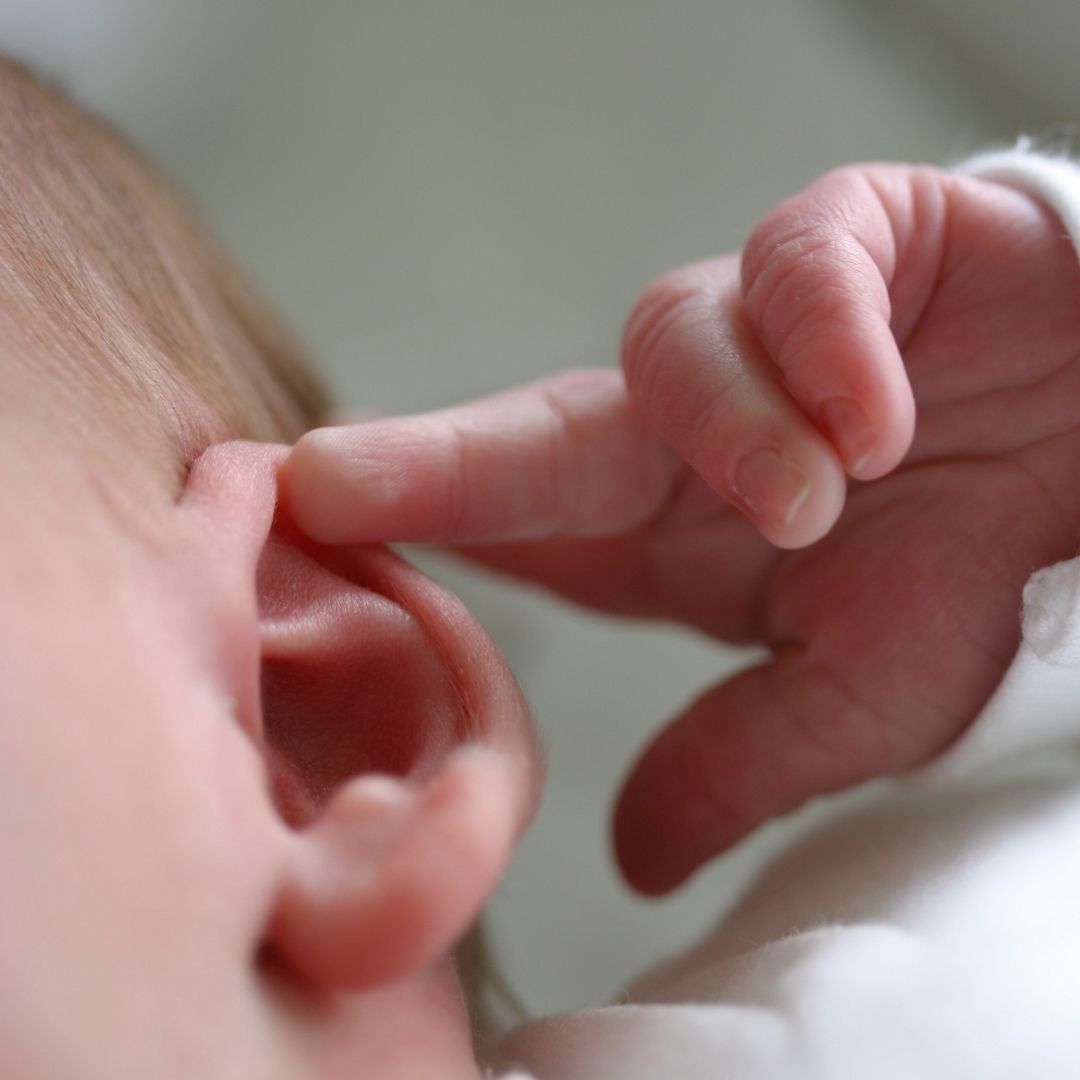 Corrector estético de orejas de bebé Corrección de orejas